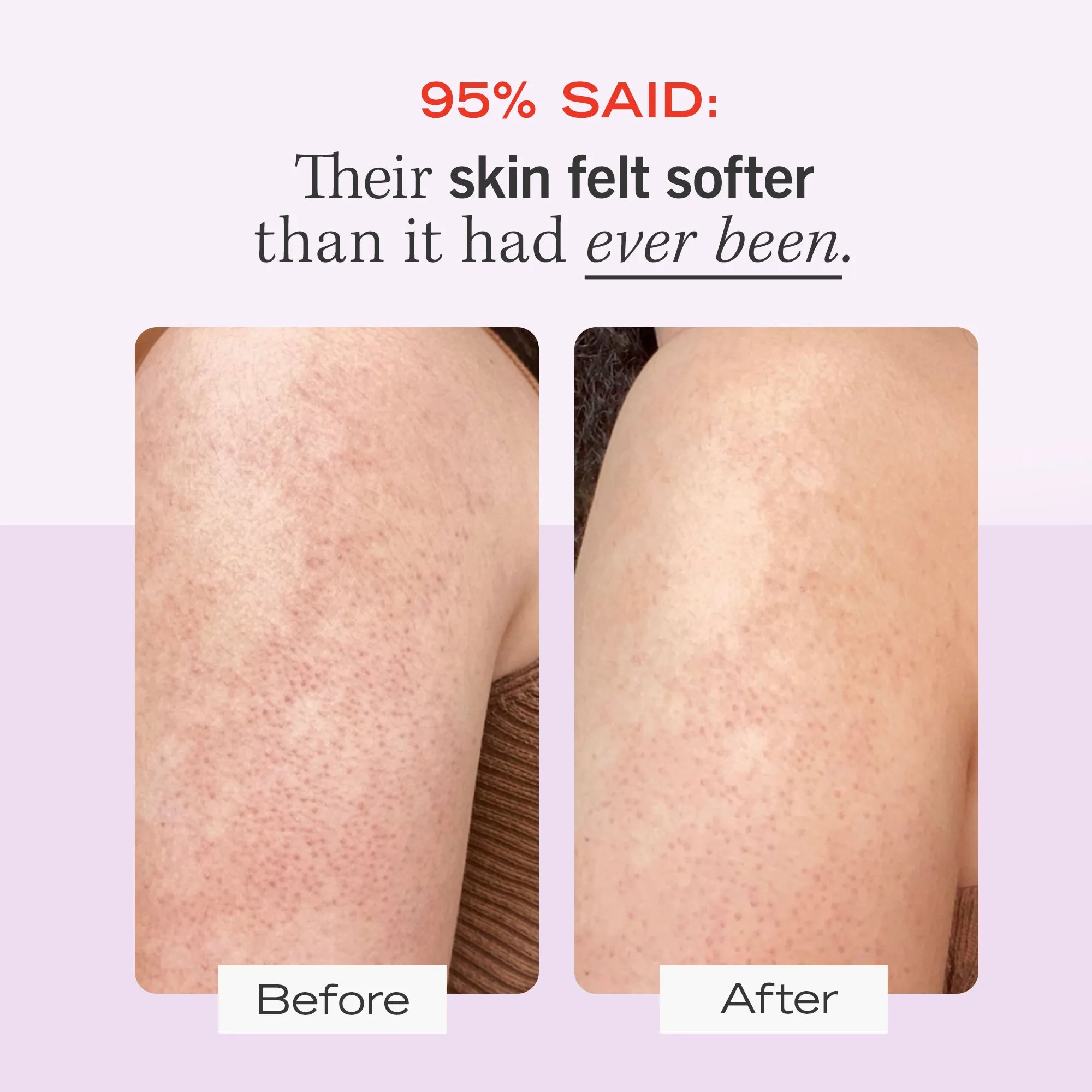 Skin SOS Body Bundle